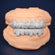 925 Sterling Silver Hip Hop 16 Dental Teeth Gurukrupa-Gems